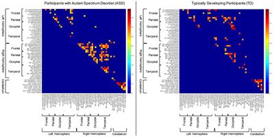 Structural Covariance of Sensory Networks, the Cerebellum, and Amygdala in Autism Spectrum Disorder
